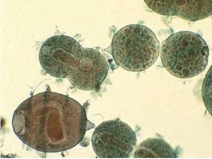 廢水中重金屬污、微生物污染物的處理方法